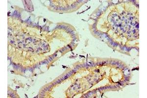 Immunohistochemistry (IHC) image for anti-serine/threonine Kinase 3 (STK3) (AA 323-450) antibody (ABIN7168990)