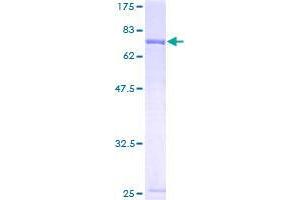 SMU1 Protein (AA 1-513) (GST tag)