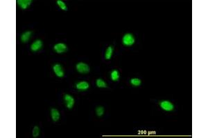 Image no. 2 for anti-Nucleophosmin (Nucleolar phosphoprotein B23, Numatrin) (NPM1) (AA 1-295) antibody (ABIN598843) (NPM1 抗体  (AA 1-295))