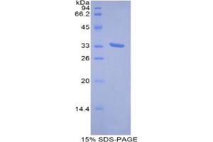 SDS-PAGE analysis of Human Metallothionein 1E Protein. (MT1E 蛋白)