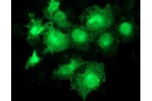 Anti-MAPRE2 mouse monoclonal antibody (ABIN2454544) immunofluorescent staining of COS7 cells transiently transfected by pCMV6-ENTRY MAPRE2 (RC200259). (MAPRE2 抗体)