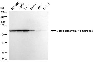 Western blotting analysis using Solute carrier family 1 member 2 antibody (ABIN7800385).