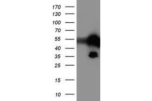 Western Blotting (WB) image for anti-T-Cell Acute Lymphocytic Leukemia 1 (TAL1) antibody (ABIN1501289)