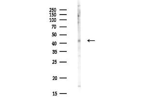 Western blot analysis of lysates from Hela cells(UV,30 min treatment), using PCM Antibody at 1/1000 dilution.