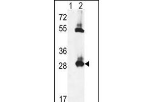 Western blot analysis of TPK1 (arrow) using rabbit polyclonal TPK1 Antibody (N-term) (ABIN653087 and ABIN2842683). (TPK1 抗体  (N-Term))