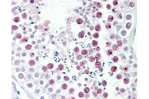 Human, Testis: Formalin-Fixed Paraffin-Embedded (FFPE). (MDC1 抗体  (AA 1851-1900))