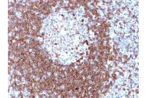 Formalin-fixed, paraffin-embedded human Tonsil stained with CD79a Rabbit Polyclonal Antibody. (CD79a 抗体  (AA 202-216))