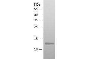 SETD8 Protein (AA 195-352) (His tag)