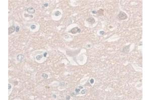 Immunohistochemistry (IHC) image for anti-Enolase 2 (Gamma, Neuronal) (ENO2) (AA 2-285) antibody (ABIN7427918)