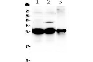 Western blot analysis of MBL2 using anti-MBL2 antibody . (MBL2 抗体  (AA 19-244))
