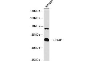 Western blot analysis of extracts of SW480 cells, using CRTAP antibody (ABIN1679366, ABIN3018913, ABIN3018914 and ABIN6220627) at 1:1000 dilution. (CRTAP 抗体  (AA 20-240))
