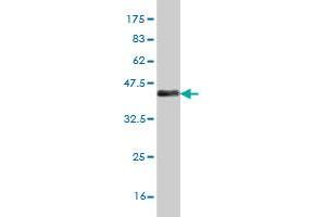 Western Blot detection against Immunogen (37 KDa) . (MEF2A 抗体  (AA 71-170))