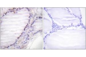 Immunohistochemistry analysis of paraffin-embedded human thyroid gland, using Fos (Phospho-Ser362) Antibody. (c-FOS 抗体  (pSer362))