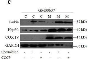 Western Blotting (WB) image for anti-Cytochrome C Oxidase Subunit IV Isoform 1 (COX4I1) (Center) antibody (ABIN2855069)