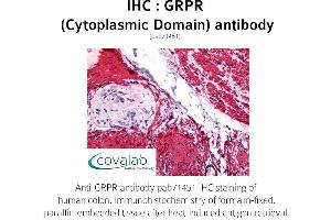 Image no. 1 for anti-Gastrin-Releasing Peptide Receptor (GRPR) (3rd Cytoplasmic Domain) antibody (ABIN1735298) (GRPR 抗体  (3rd Cytoplasmic Domain))