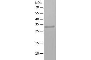 Western Blotting (WB) image for P21-Activated Kinase 2 (PAK2) (AA 227-524) protein (His tag) (ABIN7124292) (PAK2 Protein (AA 227-524) (His tag))