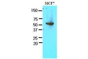 Cell lysates of MCF7 (30 ug) were resolved by SDS-PAGE, transferred to nitrocellulose membrane and probed with anti-human G6PD (1:1000). (Glucose-6-Phosphate Dehydrogenase 抗体  (AA 35-506))