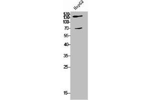 Western Blot analysis of HepG2 cells using COL5A2 Polyclonal Antibody (COL5A2 抗体  (N-Term))