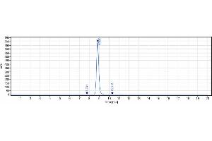 anti-SOST (Blosozumab Biosimilar) antibody