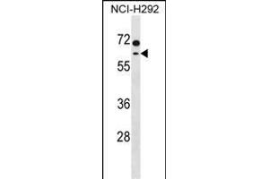 MCCC2 Antibody (C-term) (ABIN1537373 and ABIN2850364) western blot analysis in NCI- cell line lysates (35 μg/lane). (MCCC2 抗体  (C-Term))