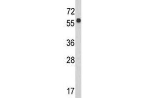 Western blot analysis of WDR1 antibody and CEM lysate. (WDR1 抗体  (AA 548-577))