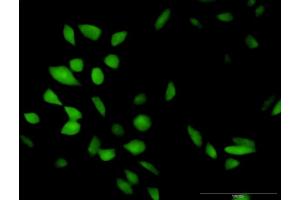 Immunofluorescence of purified MaxPab antibody to CISH on HeLa cell. (CISH 抗体  (AA 1-258))