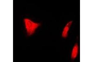 Immunofluorescent analysis of PSMD7 staining in U2OS cells. (PSMD7 抗体)