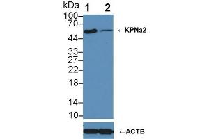 Knockout Varification:,Lane 1: Wild-type HepG2 cell lysate,Lane 2: KPNa2 knockout HepG2 cell lysate,Predicted MW: 58 kDa ,Observed MW: 58 kDa,Primary Ab: 3 μg/mL Rabbit Anti-Human KPNa2 Antibody,Second Ab: 0.