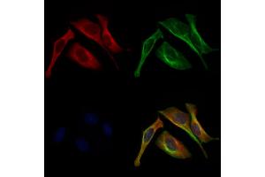 ABIN6262030 and ABIN6272943 staining 3 by IF/ICC. (GOLPH3 抗体  (C-Term))