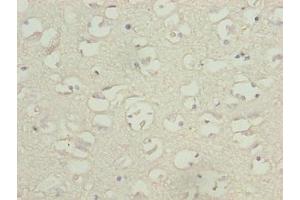 Immunohistochemistry of paraffin-embedded human brain tissue using ABIN7171598 at dilution of 1:100 (TBC1D14 抗体  (AA 136-435))