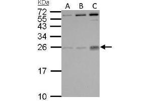 WB Image PLGF antibody detects PGF protein by Western blot analysis. (PLGF 抗体)