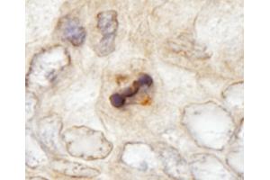 Immunohistochemistry (IHC) image for anti-Centromere Protein F (CENPF) (AA 2350-2400) antibody (ABIN7448938)