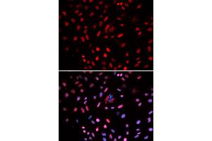 Immunofluorescence analysis of U2OS cells using POLD1 antibody. (POLD1 抗体)