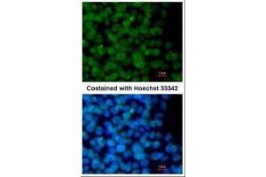 Immunofluorescence (IF) image for anti-Zinc Finger, MYM-Type 2 (ZMYM2) (Center) antibody (ABIN2856121)