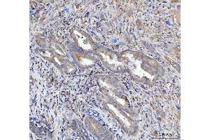 IHC analysis of PDLIM7 using anti-PDLIM7 antibody (ABIN7601048).