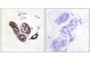 Immunohistochemistry (IHC) image for anti-Microphthalmia-Associated Transcription Factor (MITF) (Ser180), (Ser73) antibody (ABIN1847958) (MITF 抗体  (Ser73, Ser180))