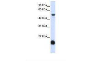 Image no. 1 for anti-Solute Carrier Family 22 (Organic Cation Transporter), Member 7 (SLC22A7) (AA 72-121) antibody (ABIN6738027) (SLC22A7 抗体  (AA 72-121))
