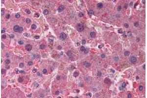 Human Liver (formalin-fixed, paraffin-embedded) stained with AHSG antibody ABIN291878 at 2. (Fetuin A 抗体)