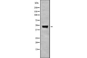 Western blot analysis ABHD3 using K562 whole cell lysates. (ABHD3 抗体)