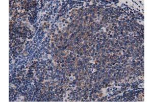 Immunohistochemical staining of paraffin-embedded Human colon tissue using anti-DNAJA2 mouse monoclonal antibody. (DNAJA2 抗体)