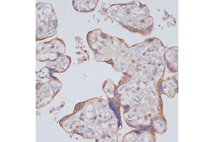 Immunohistochemistry of paraffin-embedded human placenta using PI3 Kinase p85 beta antibody (ABIN7269320) at dilution of 1:200 (40x lens). (PIK3R2 抗体)