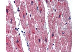 Immunohistochemistry (IHC) image for anti-RNA Binding Motif Protein 24 (RBM24) (Middle Region) antibody (ABIN2776655) (RBM24 抗体  (Middle Region))