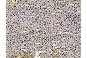 ABIN7096566 and ABIN7100630 at 1/100 staining mouse liver tissue by IHC-P.