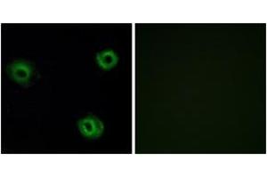 Immunofluorescence analysis of A549 cells, using NTR2 Antibody. (NTSR2 抗体  (AA 151-200))
