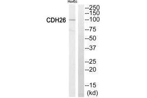 Western blot analysis of extracts from HuvEc cells, using Cytochrome P450 2C8 antiobdy. (CYP2C8 抗体)