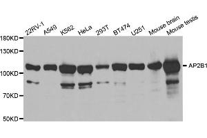 Western blot analysis of extracts of various cell lines, using AP2B1 antibody (ABIN5971039) at 1/1000 dilution. (AP2B1 抗体)