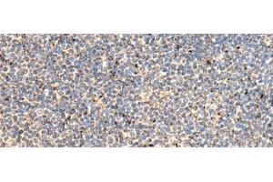 Immunohistochemistry of paraffin-embedded Human tonsil tissue using PTH1R Polyclonal Antibody at dilution of 1:65(x200) (PTH1R 抗体)