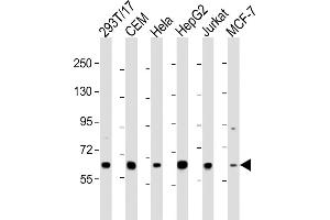 All lanes : Anti-RNF31 Antibody (C-term) at 1:2000 dilution Lane 1: 293T/17 whole cell lysate Lane 2: CEM whole cell lysate Lane 3: Hela whole cell lysate Lane 4: HepG2 whole cell lysate Lane 5: Jurkat whole cell lysate Lane 6: MCF-7 whole cell lysate Lysates/proteins at 20 μg per lane. (RNF31 抗体  (C-Term))