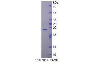 SDS-PAGE (SDS) image for Calpain 1 (CAPN1) (AA 185-356) protein (His tag) (ABIN1169983) (CAPN1 Protein (AA 185-356) (His tag))