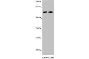 Western blot All lanes: STXBP2 antibody at 5. (STXBP2 抗体  (AA 1-280))